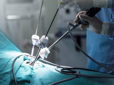 МБАЛ Добрич с нова апаратура за безкръвни операции – лапароскопски сет и борираща система за ортопедия