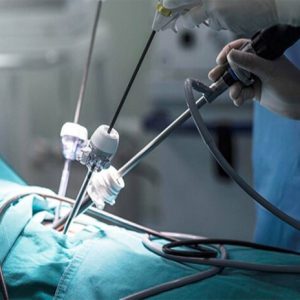 МБАЛ Добрич с нова апаратура за безкръвни операции – лапароскопски сет и борираща система за ортопедия